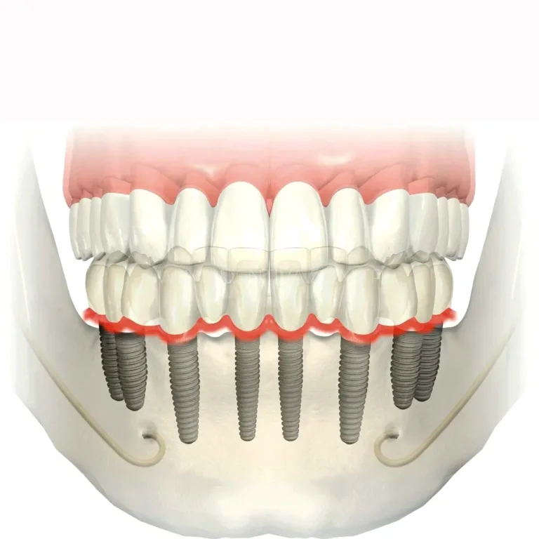 a155 tryrtyrty